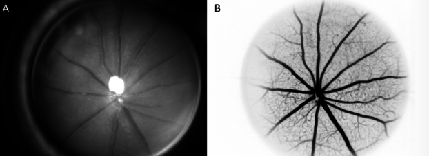 Mausmodell retinale Gefässdiagnostik