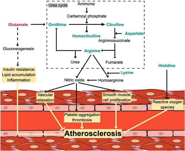 Atherosclerosis